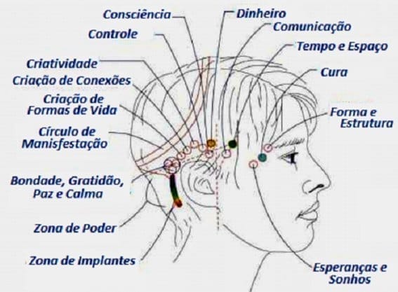 Barra de Access: o que é, como funciona, para que serve e os 32 pontos da terapia 3 32 pontos barra de access